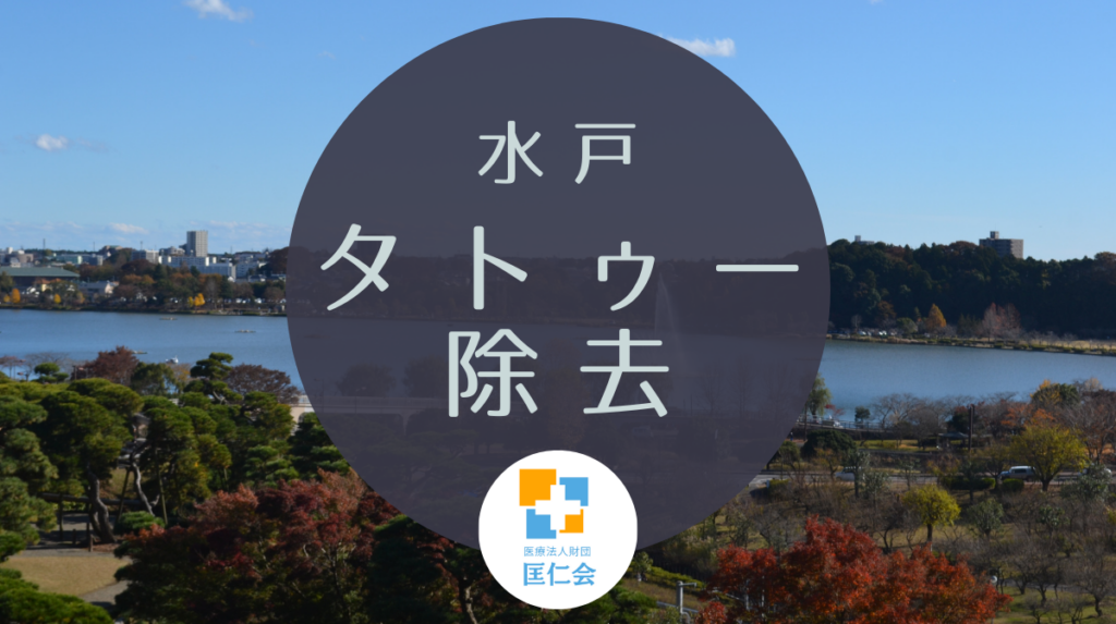 水戸　タトゥー除去　安い